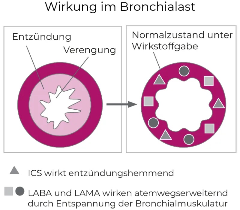 Illustration Wirkung im Bronchialast.