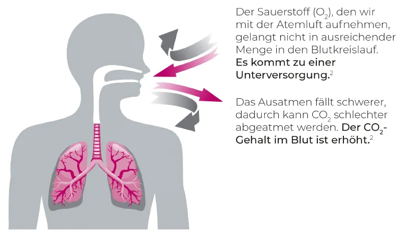 Grafik eines Menschen mit Lungen.